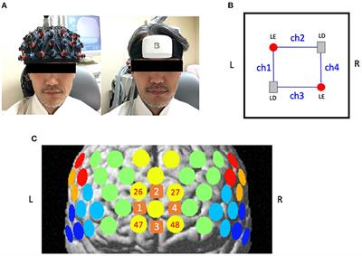 Similar Hemodynamic Signal Patterns Between Compact NIRS and 52-Channel NIRS During a Verbal Fluency Task